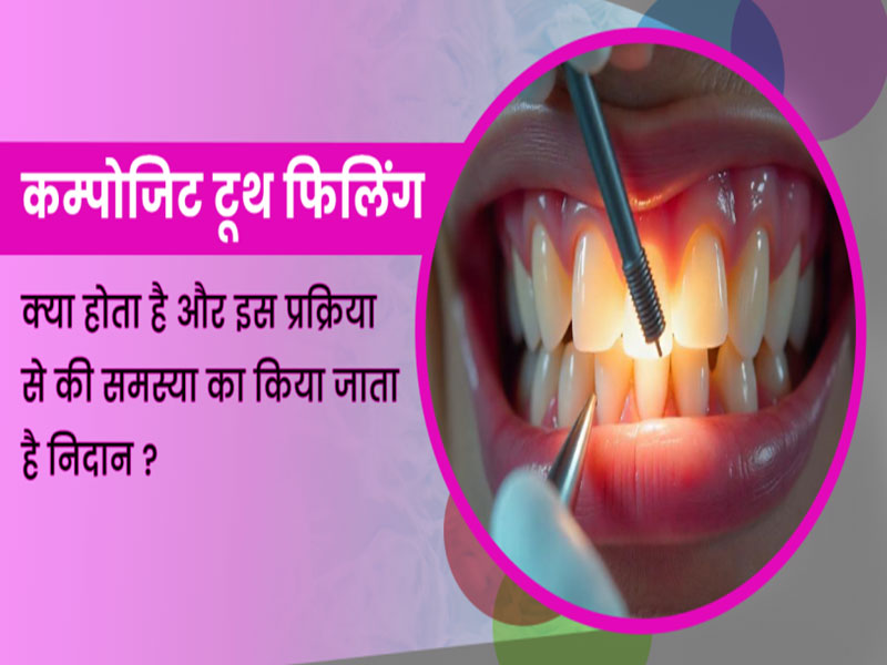 khare dental clinic blog