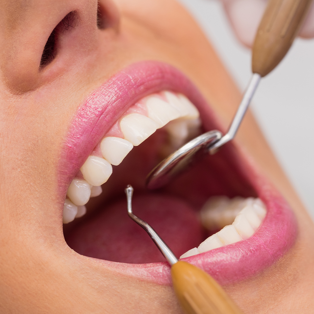 Khare Dental Cosmetic-Dentistry